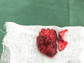 Photo 12-06-2017, 11 43 23 AM