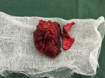 Photo 12-06-2017, 11 43 29 AM