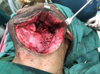 Photo 12-06-2017, 12 08 25 PM