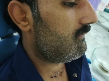 Photo 18-10-2017, 1 45 42 PM (2)