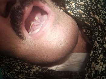 Photo 18-10-2017, 1 52 30 PM (3)