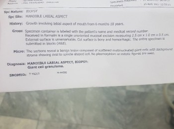 Photo 18-10-2017, 1 52 31 PM (2)