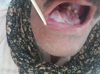 Photo 18-10-2017, 1 52 31 PM (3)