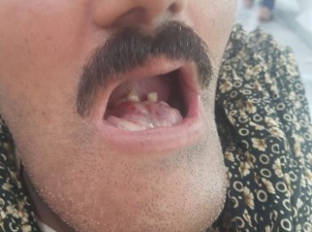 Photo 18-10-2017, 1 52 31 PM