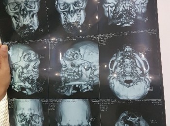 Photo 18-10-2017, 1 52 52 PM