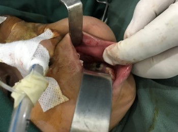 Photo 22-05-2017, 9 21 27 AM