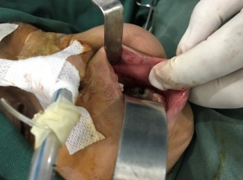 Photo 22-05-2017, 9 21 29 AM