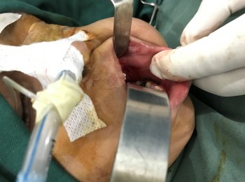 Photo 22-05-2017, 9 21 35 AM