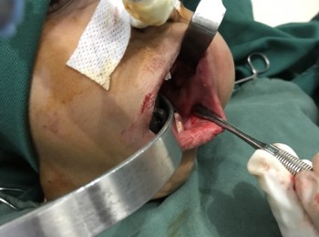 Photo 22-05-2017, 9 25 49 AM