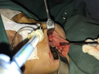 Photo 22-05-2017, 9 26 12 AM