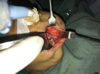 Photo 22-05-2017, 9 32 56 AM