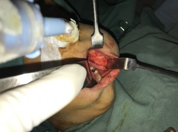 Photo 22-05-2017, 9 32 59 AM