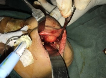 Photo 22-05-2017, 9 38 01 AM