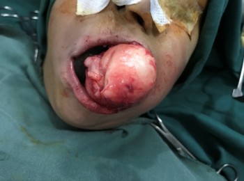 Photo 22-05-2017, 9 44 39 AM