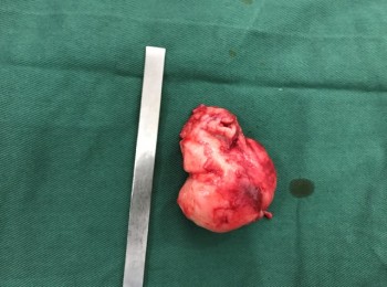 Photo 22-05-2017, 9 48 01 AM