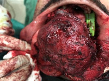 Photo 24-08-2017, 10 53 56 AM (1)