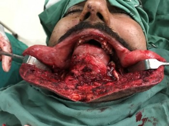 Photo 24-08-2017, 11 23 41 AM