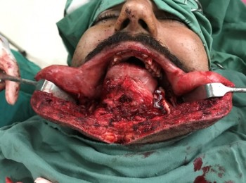 Photo 24-08-2017, 11 23 44 AM