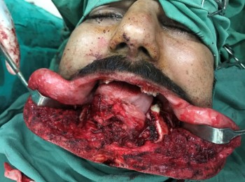 Photo 24-08-2017, 11 23 57 AM (1)