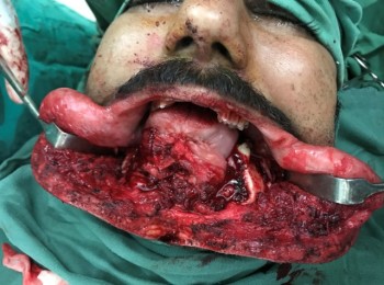 Photo 24-08-2017, 11 24 01 AM