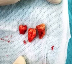 Photo 31-05-2017, 7 36 58 PM